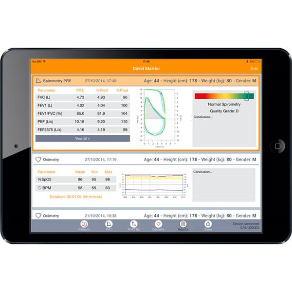 Σπιρομετρο Spirobank II Smart χωρις Τουρμπινες Mir Σπιρομετρο Spirobank II Smart χωρις Τουρμπινες Mir