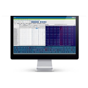 CardioScan 12 Top Software για Holter Ανιχνευσης Καρδιακου Ρυθμου DMS CardioScan 12 Top Software για Holter Ανιχνευσης Καρδιακου Ρυθμου DMS