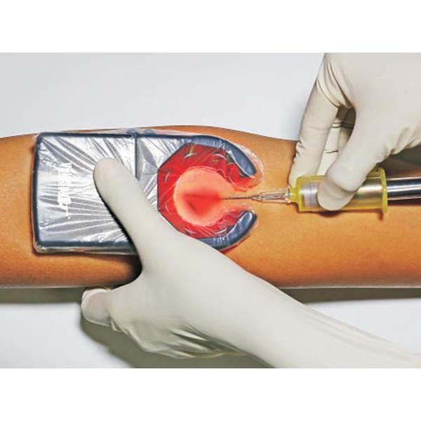 Ανιχνευτης φλεβων Χειρος Veinspy Vein Finder Gima