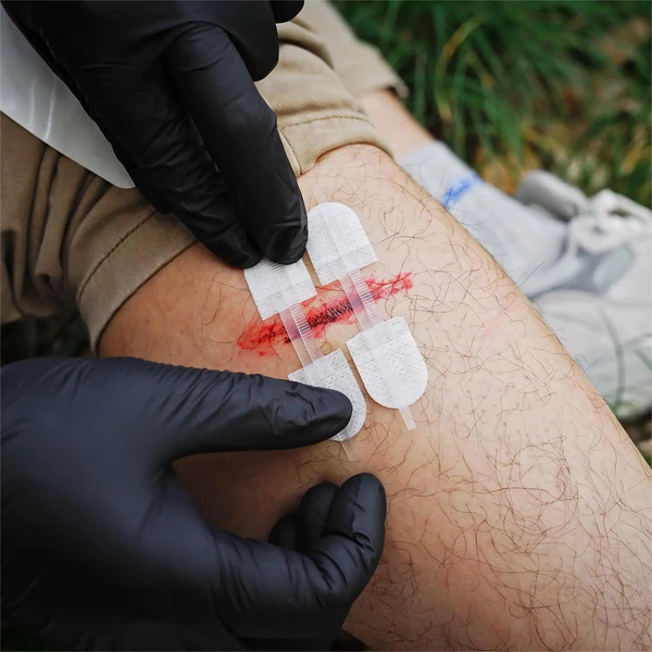 Σετ Συρραφης Περιποιησης Τραυματων Rhino Rescue Wound Closure Kit
