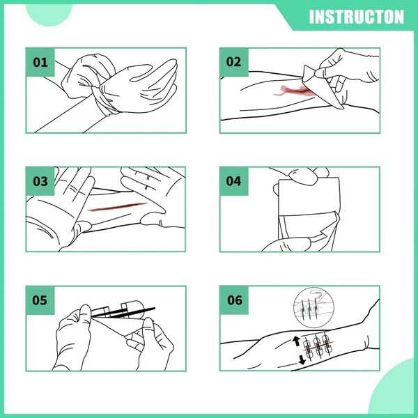 Σετ Συρραφης Περιποιησης Τραυματων Rhino Rescue Wound Closure Kit
