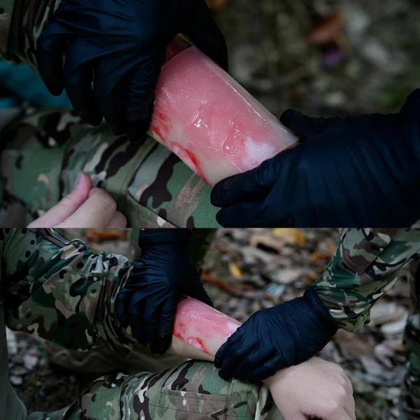 Σετ Εγκαυματων Rhino Rescue Burn Kit